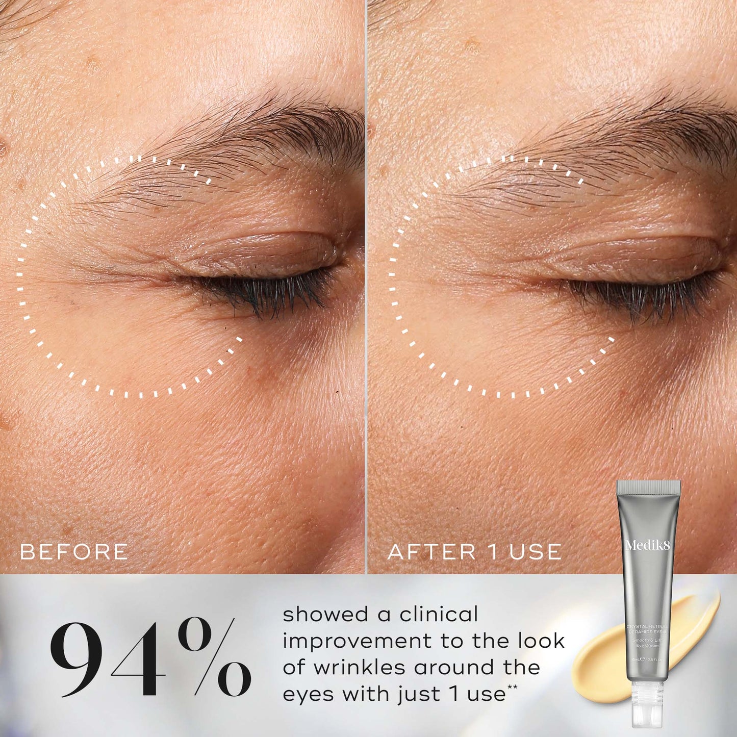 Medik8 Crystal Retinal Ceramide Eye clinically proven before and after results