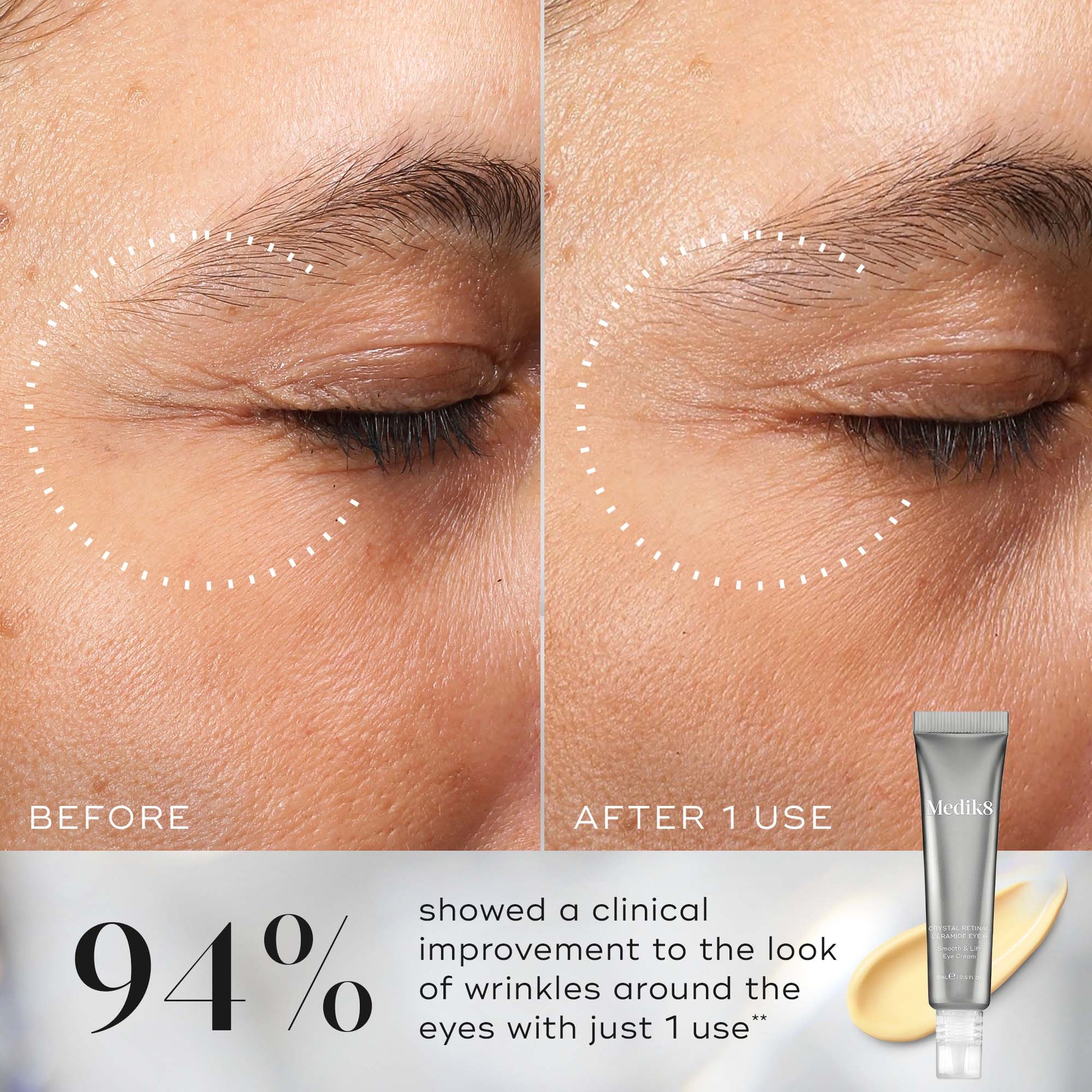 Medik8 Crystal Retinal Ceramide Eye clinically proven before and after results
