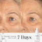 Medik8 Liquid Peptides before and after showing younger-looking skin in just 7 days