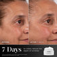 Side-by-side before and after photographs of a woman's face over 7 days using Medik8 Advanced Pro-Collagen+ Peptide Cream, showing visibly reduced wrinkle depth.