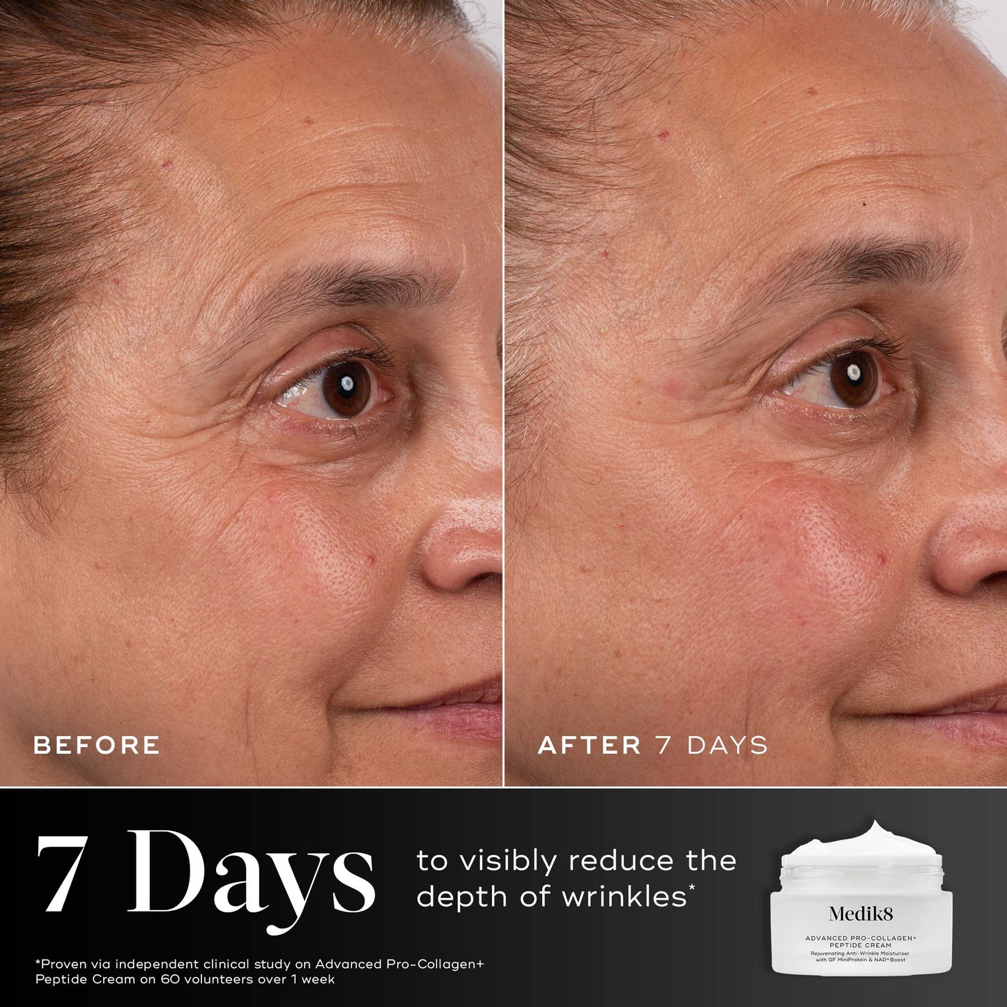 Side-by-side before and after photographs of a woman's face over 7 days using Medik8 Advanced Pro-Collagen+ Peptide Cream, showing visibly reduced wrinkle depth.