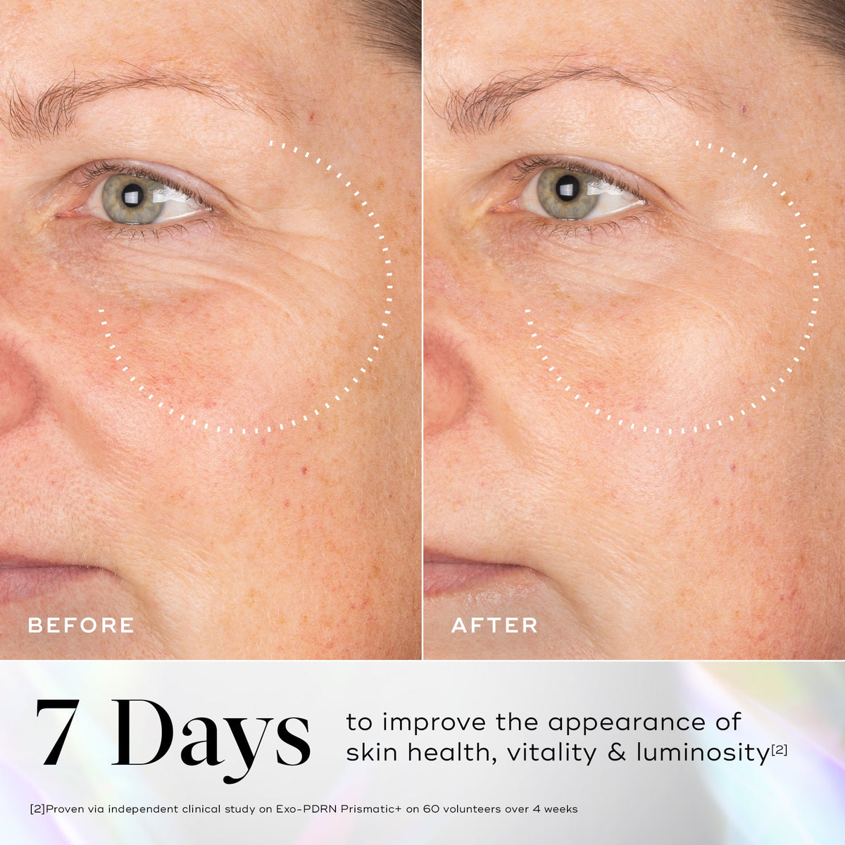 Medik8 EXO-PDRN Prismatic+ before and after results