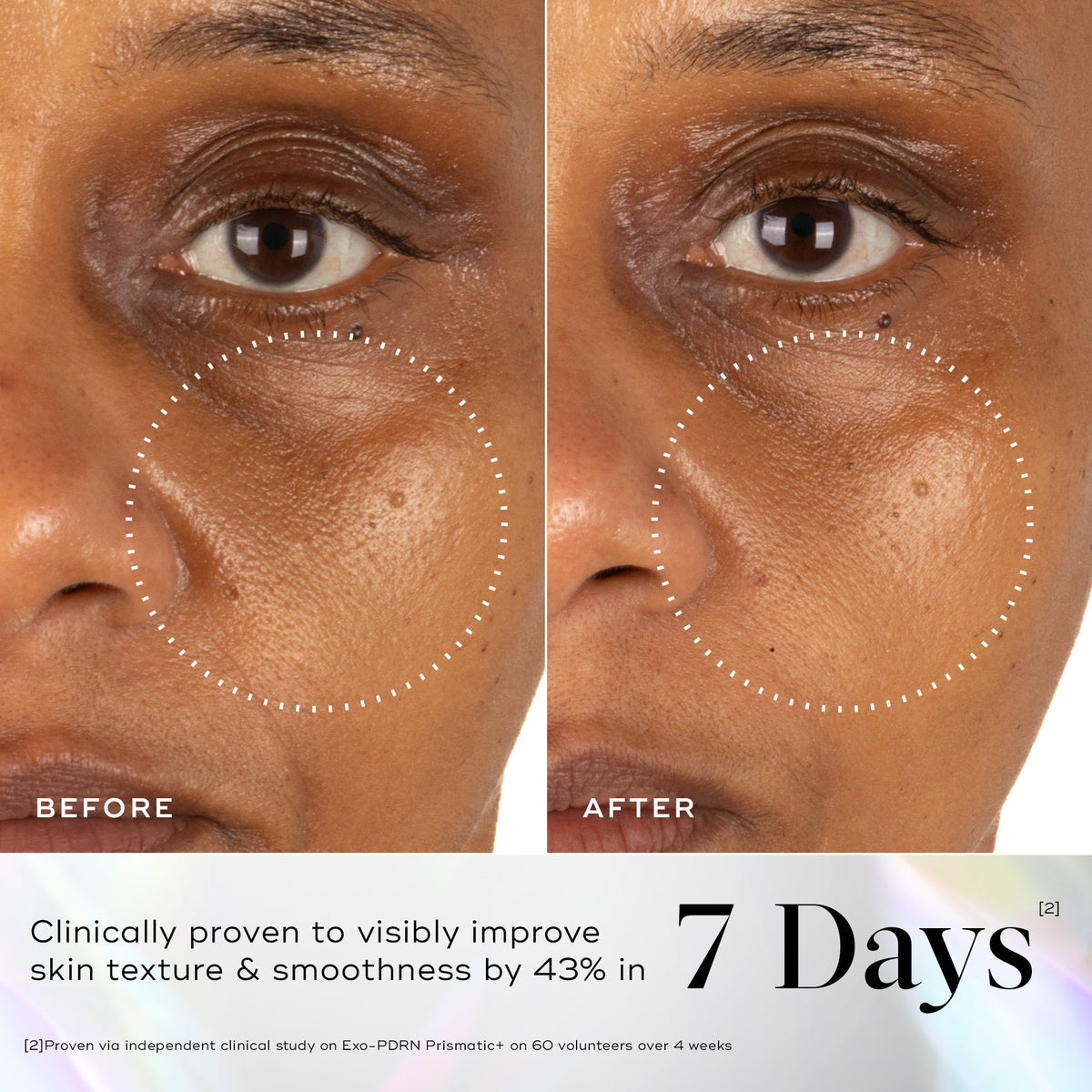 Medik8 EXO-PDRN Prismatic+ before and after results