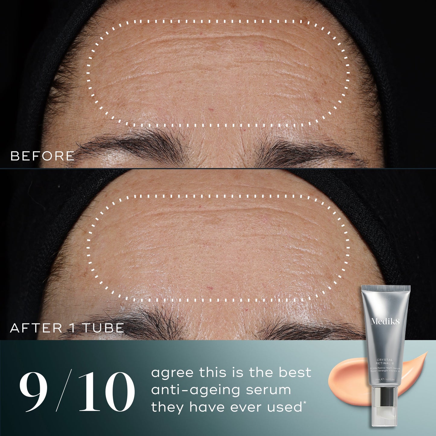 Medik8 Crystal Retinal clinically proven before and after results